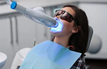 blanchiment-dentiare