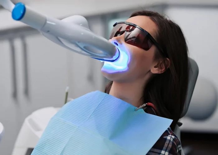 blanchiment-dentiare