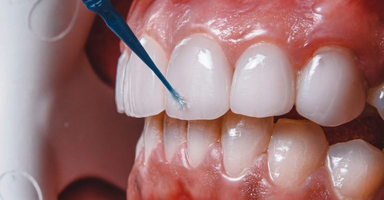 ozkan-guner-oJFXtJPV9Pg-unsplash