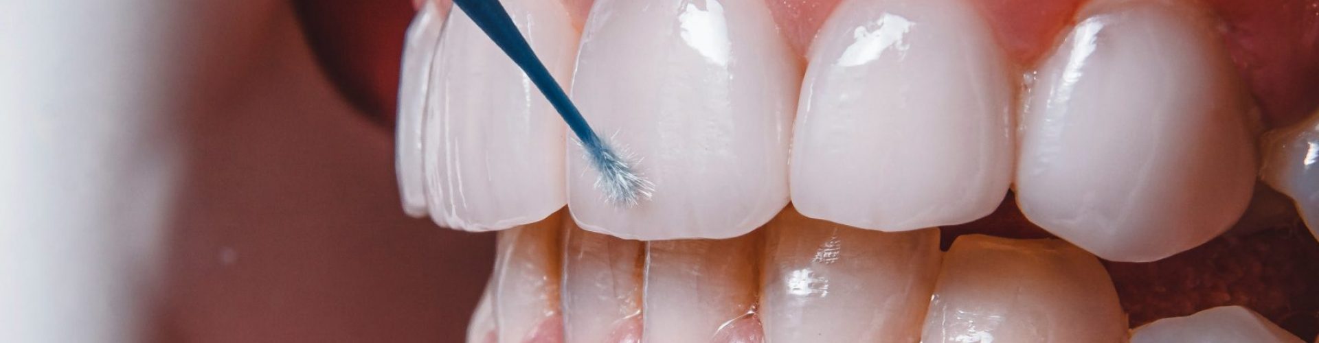 ozkan-guner-oJFXtJPV9Pg-unsplash